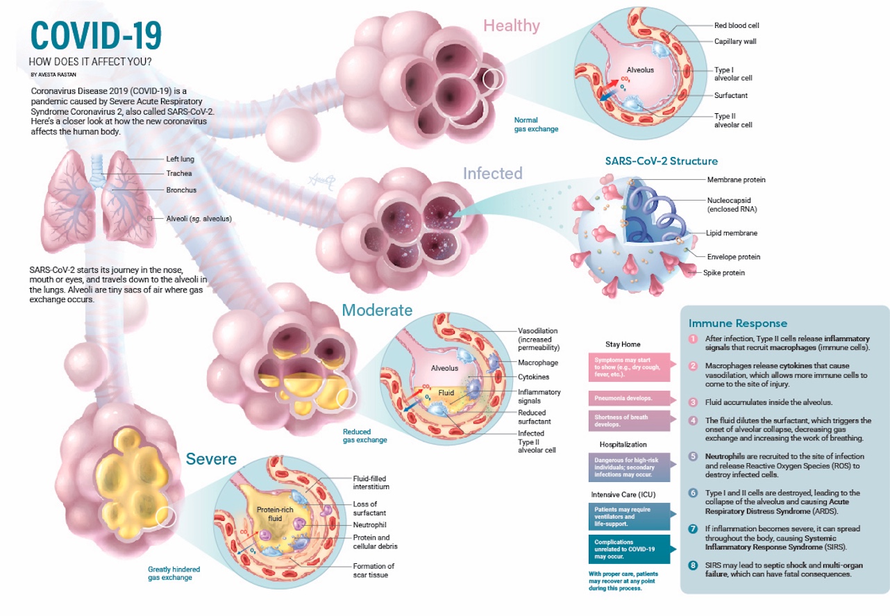 COVID-19: How Does It Affect You? | Discover Magazine