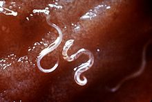 220px-Hookworms.jpg