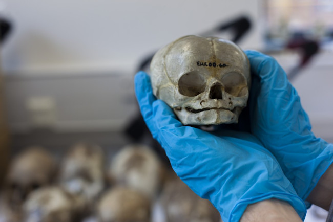 infant-skull-1024x683.jpg