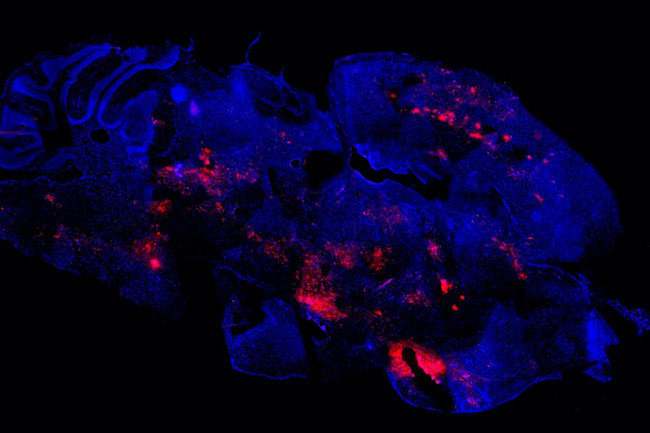 Semliki Forest virus mice