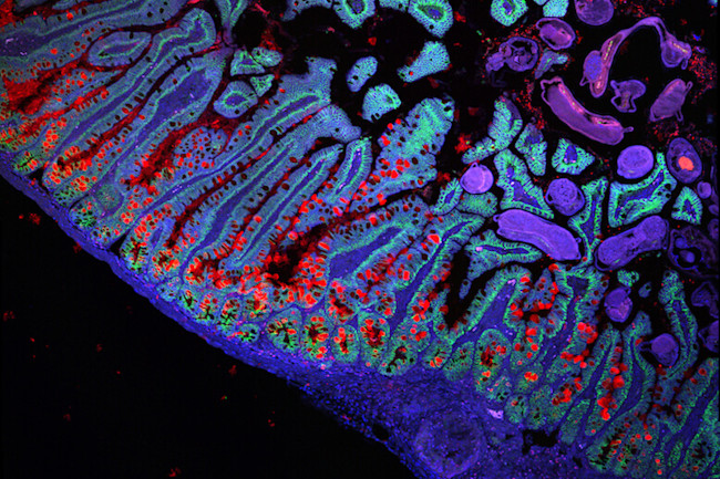 Small Intestine Cells - Broad Institute