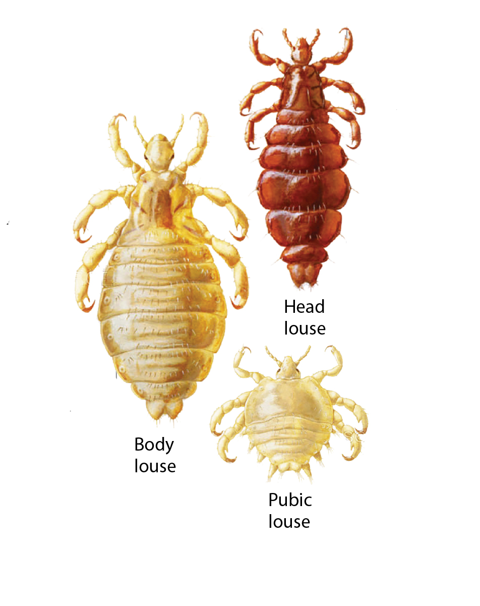 bugs found in human hair