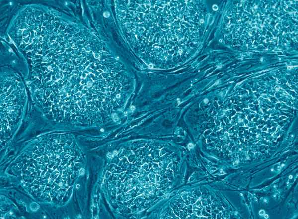 Human_embryonic_stem_cells.jpg