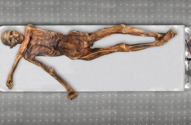 An overhead photo of the Iceman Ötzi mummy lying on a white table