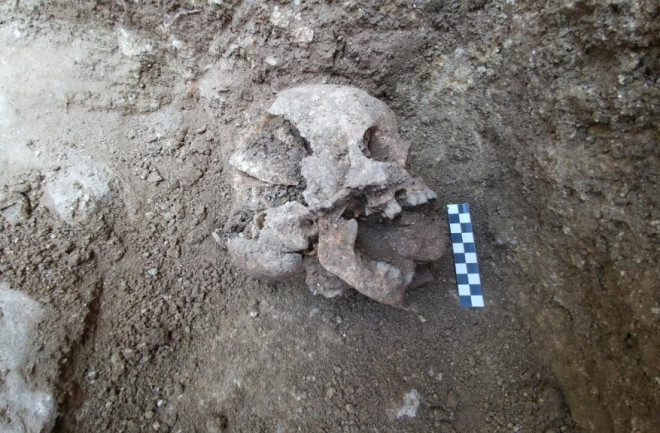 child skull with rock in mouth