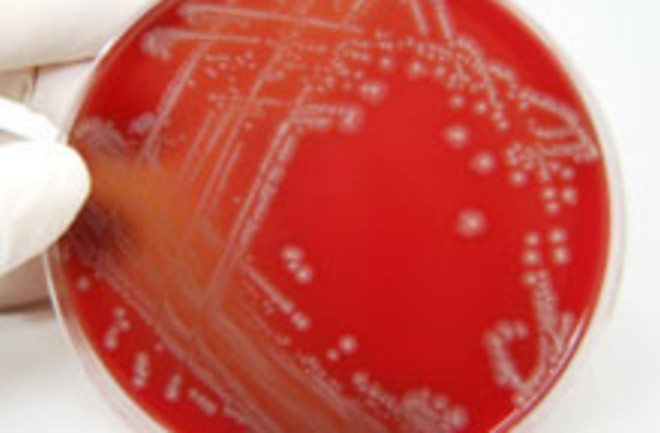 e-coli-bacteria.jpg