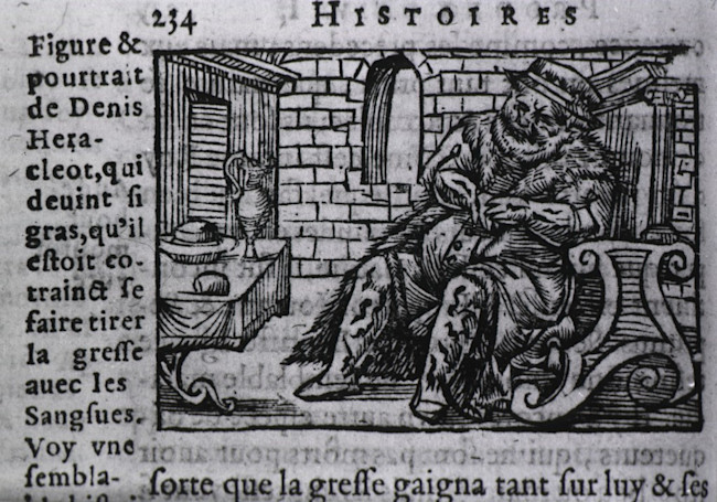 leech_obesity_woodcut-1024x717.jpg