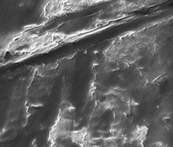 microscopic-tooth.jpg