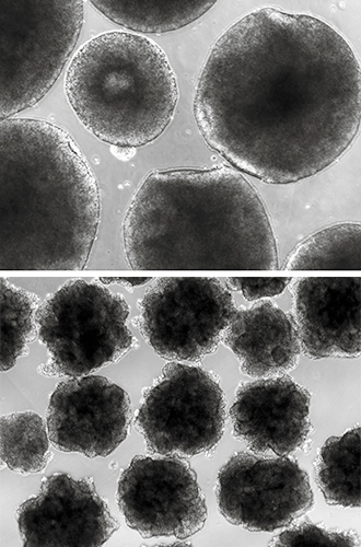 brain-organoids.jpg