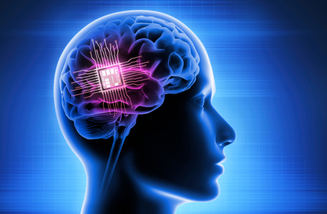 brain computer chip 