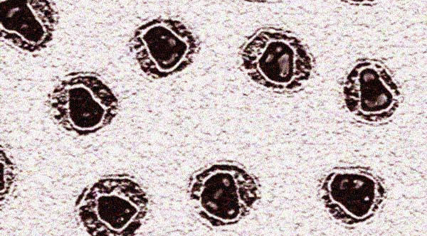 Retroviruses.jpg