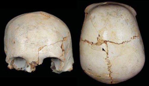 Cranium14.jpg