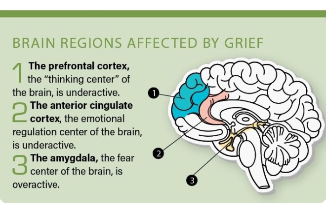 An image of the brain with areas highlighted.  Several brain centers are affected by grief.