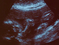 24weeks.gif