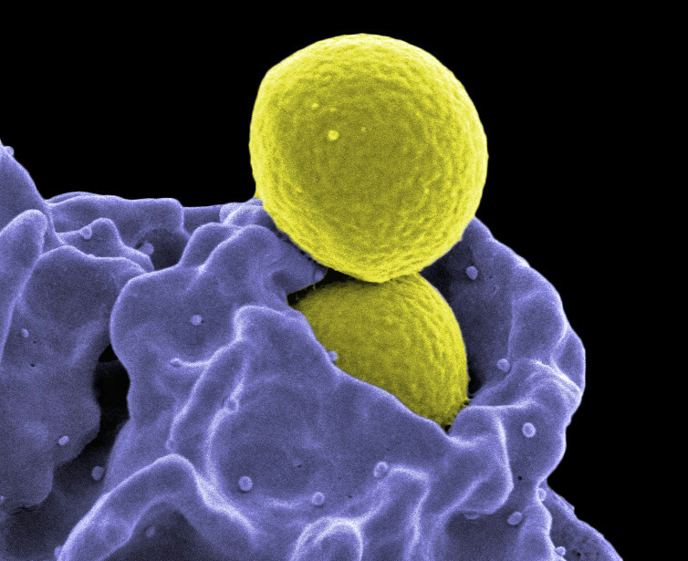 MRSA-2.jpg