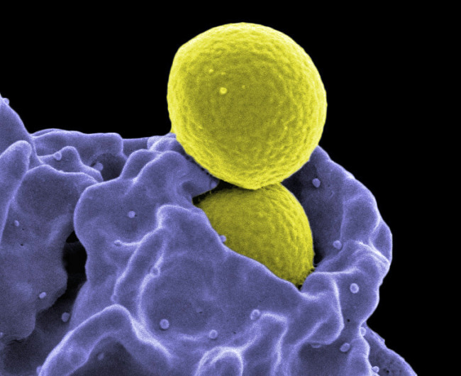 Eliminating resistant bacteria with nanoparticles | ETH Zurich