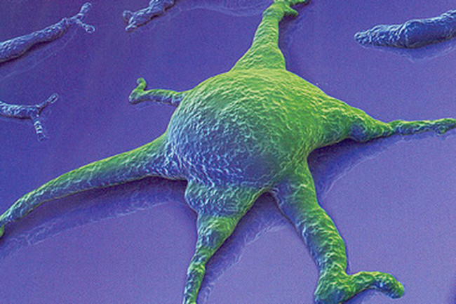 Stem-cell.jpg