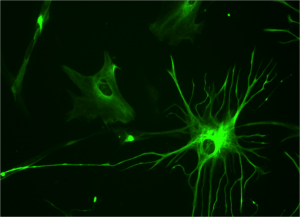 astrocyte-e1330971294191.png