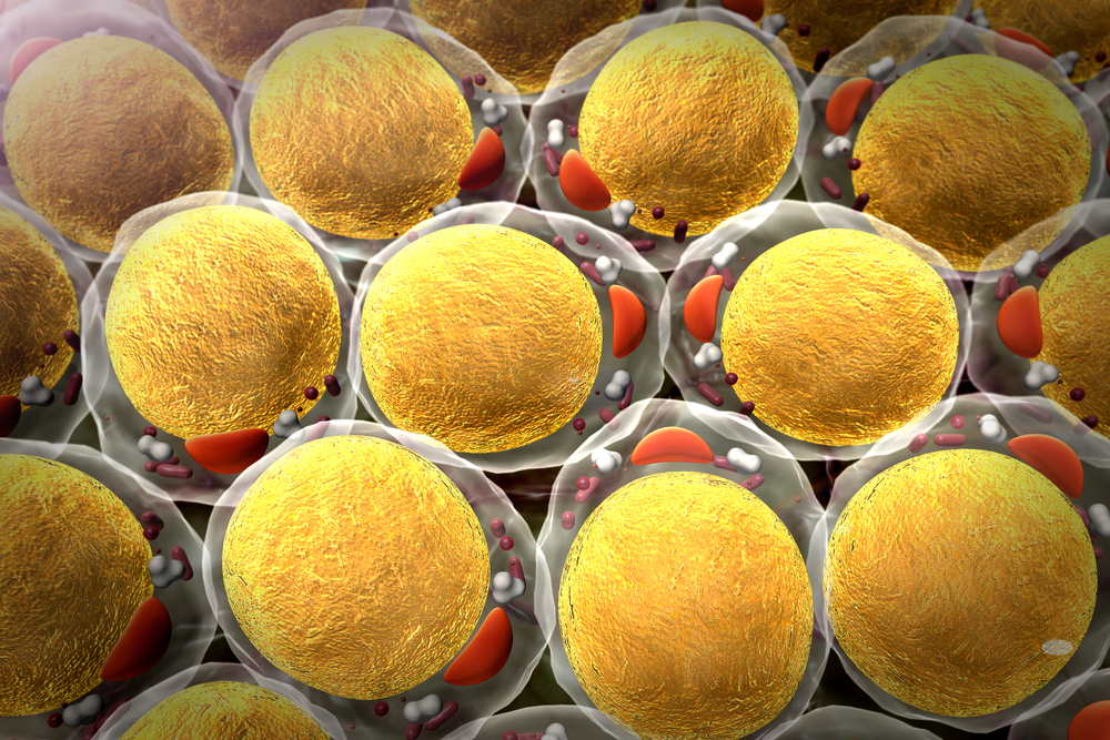 Your Fat Cells Never Disappear — Making Future Weight Gain More Likely