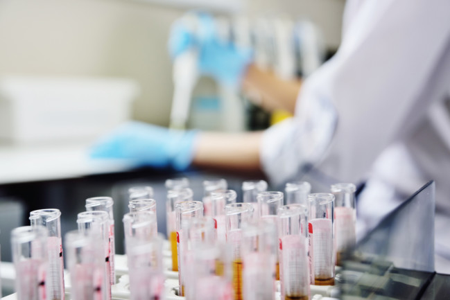 Lab Work Genetic Blood Crispr HIV - Shutterstock