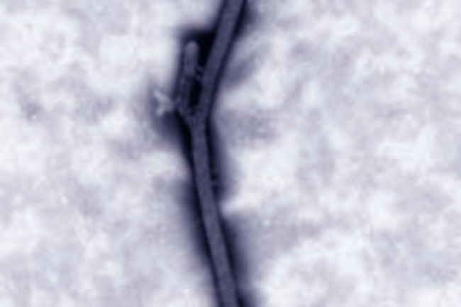 Ebola_reston.jpg