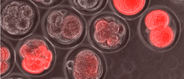 stem-cells.png