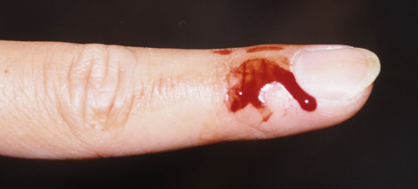 Wear_a_glove_next_time.jpg