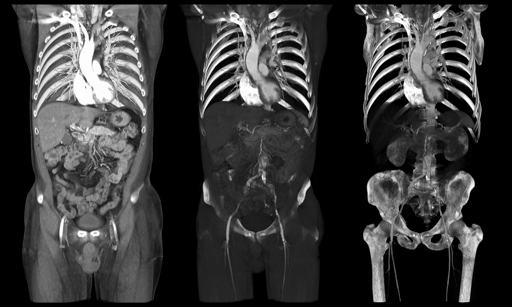 x ray body scanner