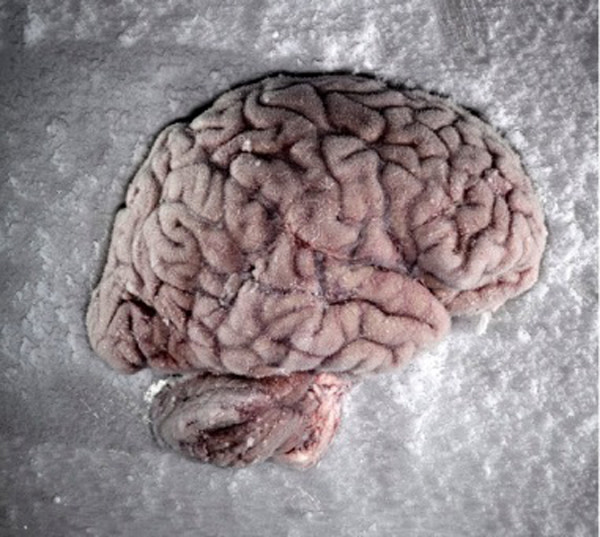 brain-on-ice.jpg