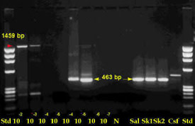 pcr_gel.jpg