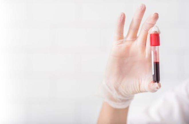 Blood Test Vial - Shutterstock