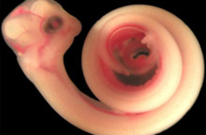 snake-embryo.jpg