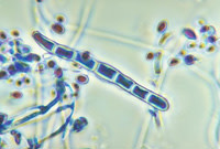 trichophyton