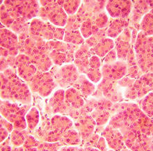 pancreatic-cells1.jpg