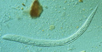 strongyloides_stercoraliz_l.jpg