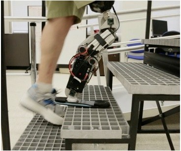 Bionic-limb.jpg