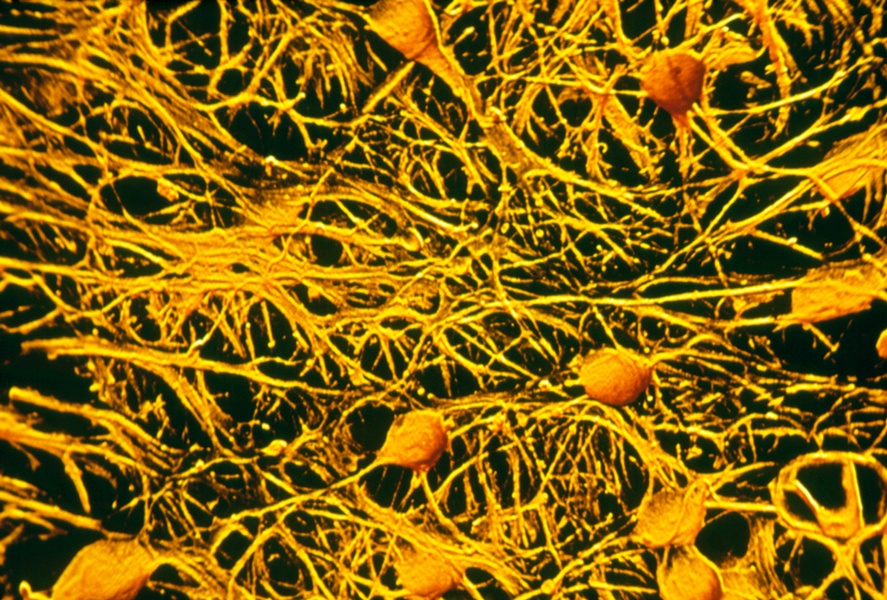 human-brain-cells