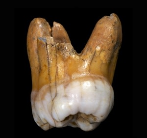 Densiovan Tooth - Max Planck