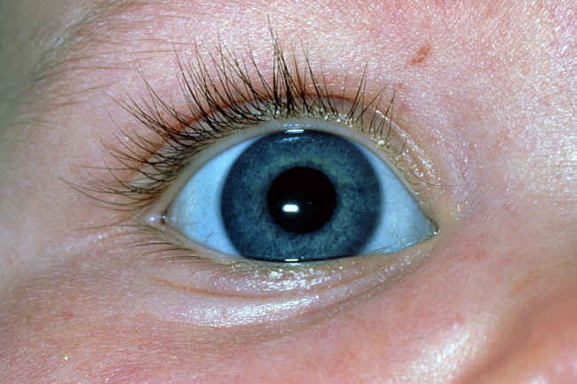 Eye of the Beholder | Discover Magazine Eye of the Beholder | Discover Magazine