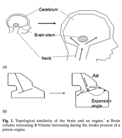 brainfig.png