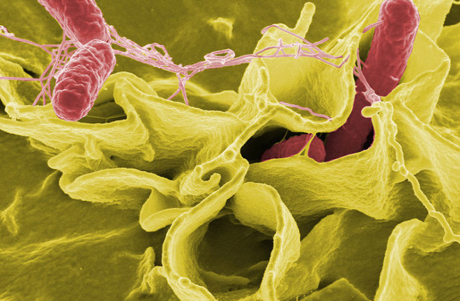 Salmonella bacteria - NIH