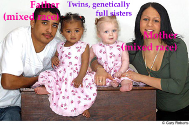 Can You Tell If You Re Black Or White Discover Magazine
