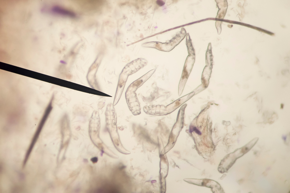 Face-Dwelling Mites Could Be Spiraling Towards Extinction