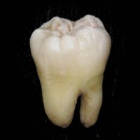 Molar.jpg