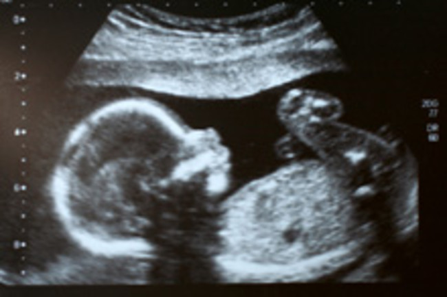 fetus.jpg