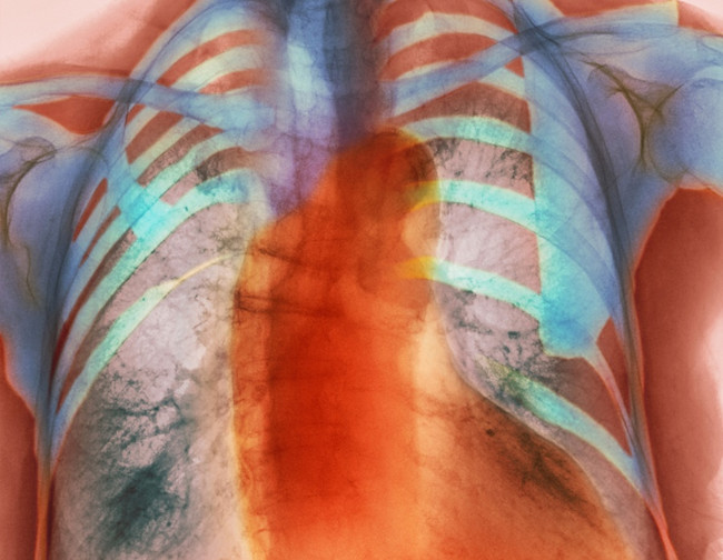 heart muscles
