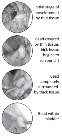Bead_diagram.jpg