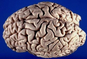 Brain_300.jpg