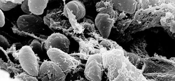 Yersinia_pestis.jpg