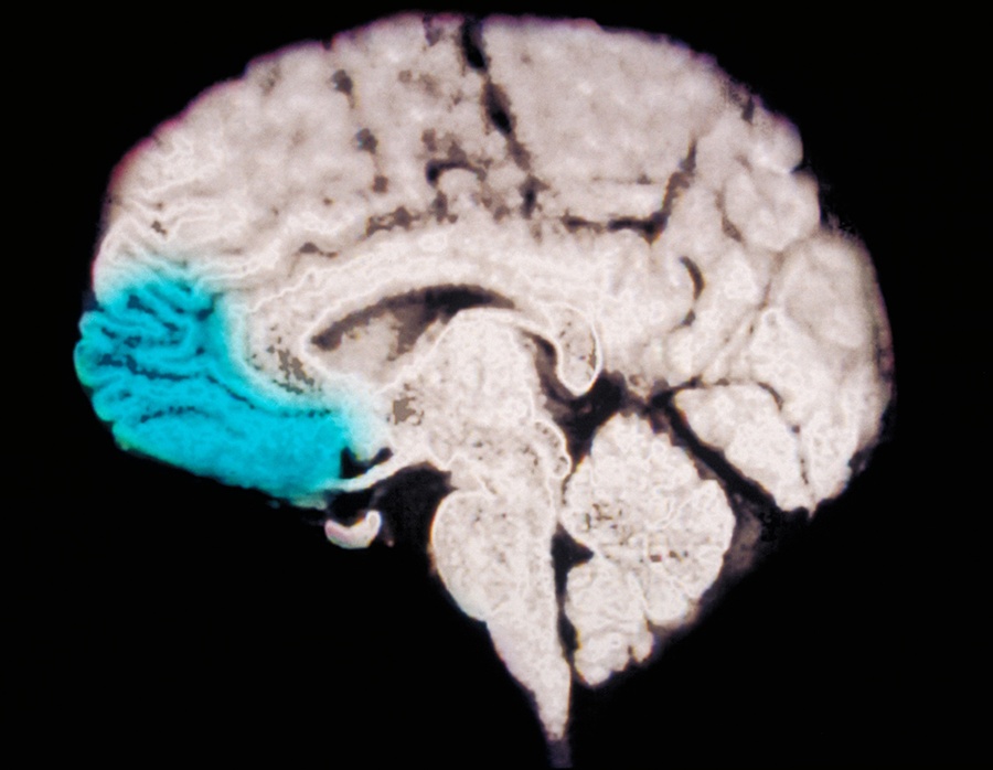 prefrontal cortex